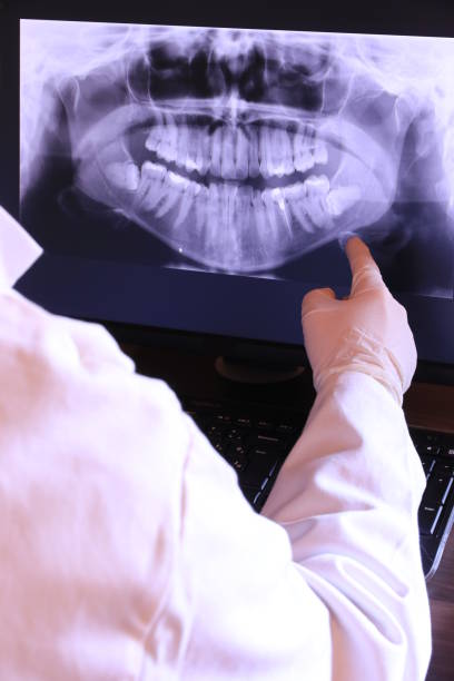Best Teeth Whitening  in St Paul, TX